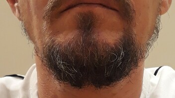 Bartfrisuren mit wenig bartwuchs